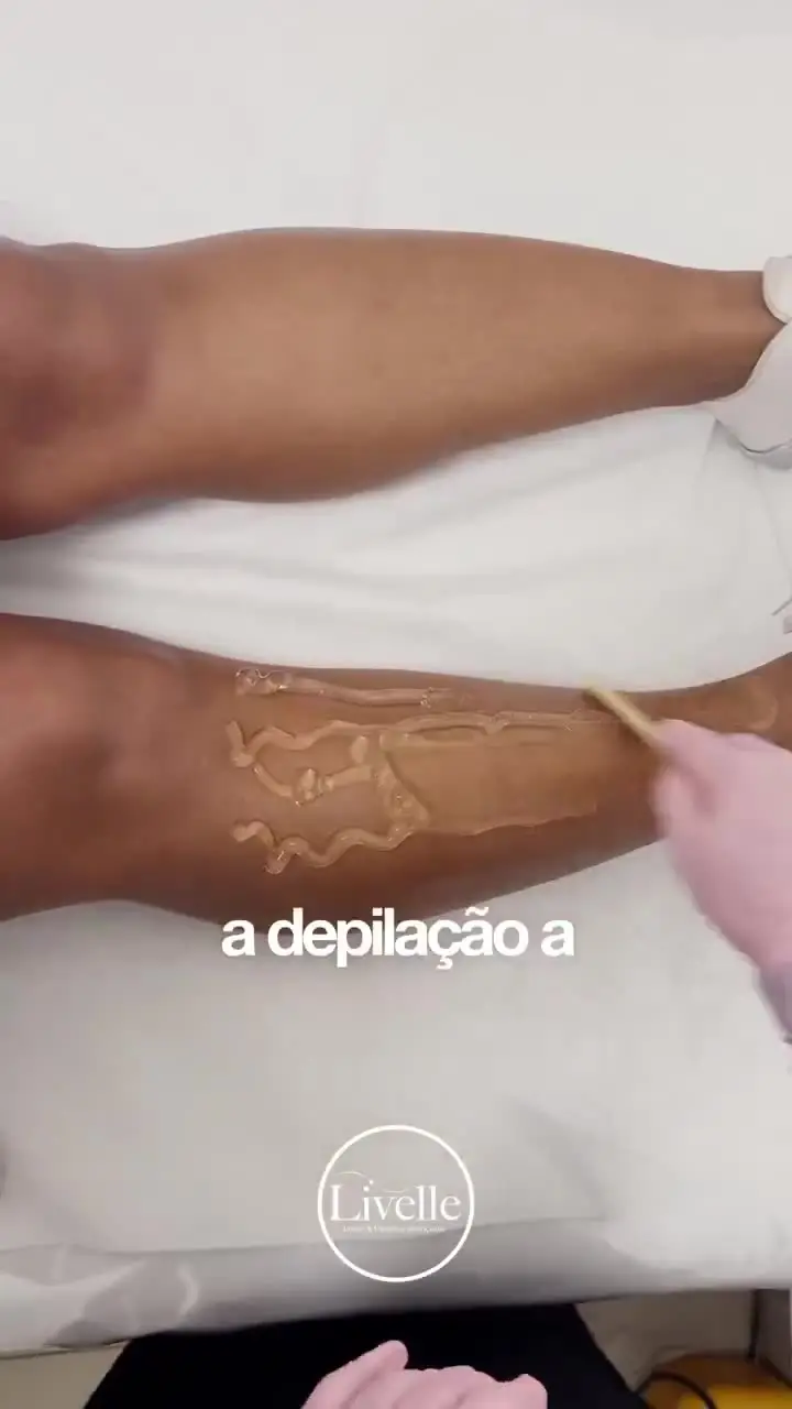 Vídeo: Depilação a laser